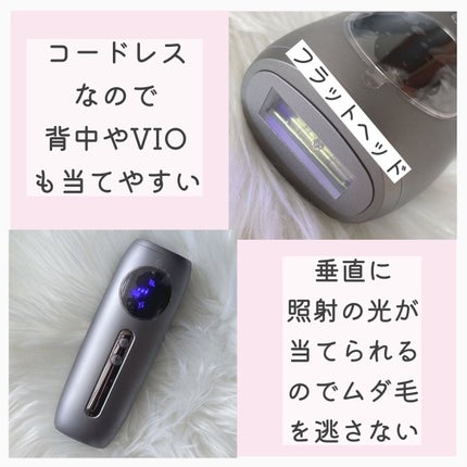 試してみた】Noend コードレス脱毛器のリアルな口コミ・レビュー 試してみた】Noend コードレス脱毛器のリアルな口コミ・レビュー