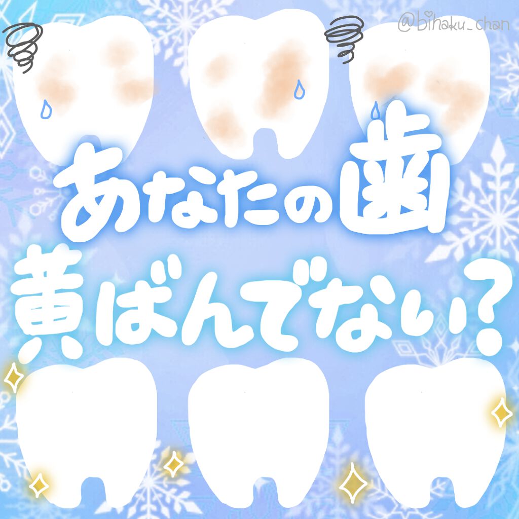 オクチレモン（マウスウォッシュ）/オクチシリーズ/マウスウォッシュ・スプレーを使ったクチコミ（1枚目）