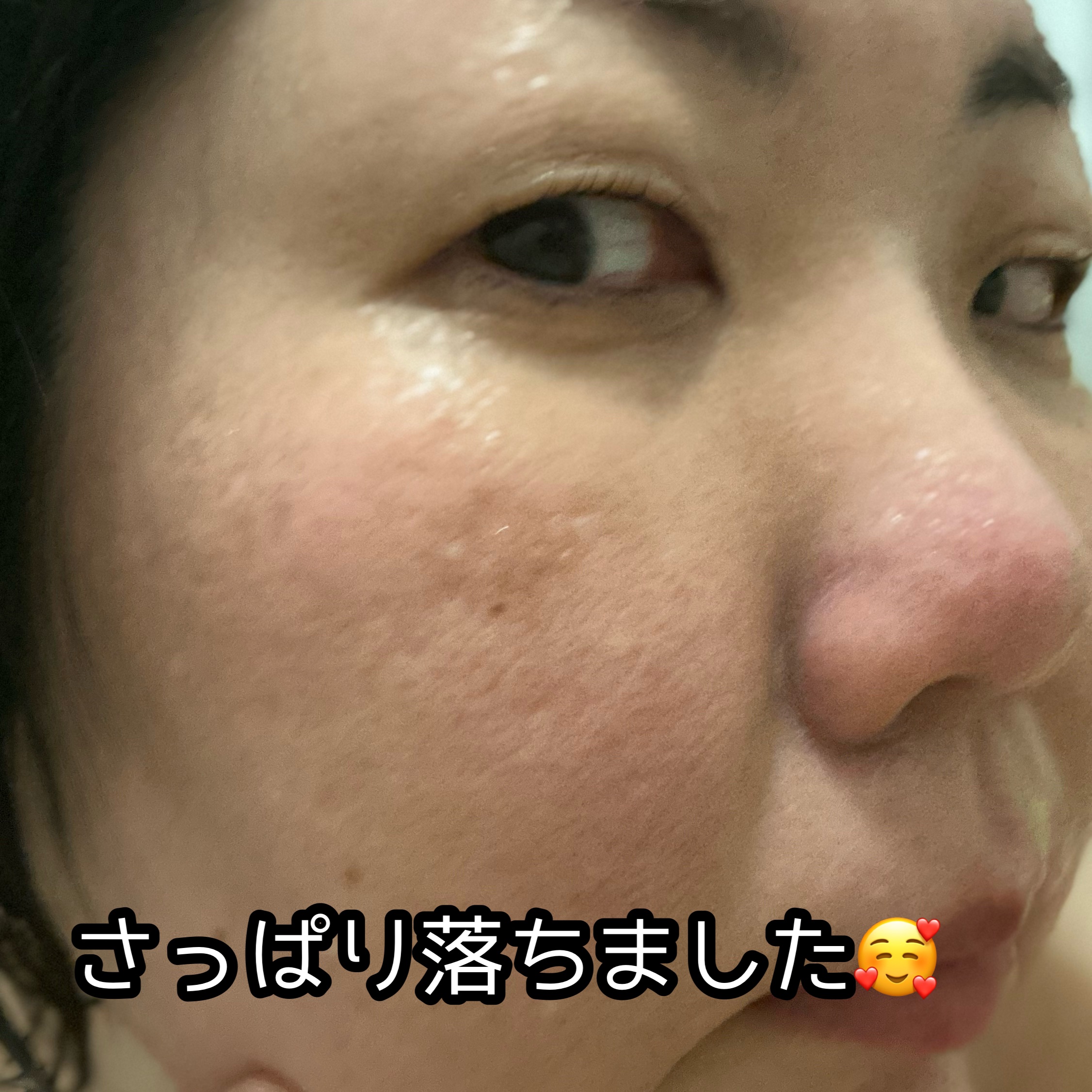 ドクダミ ポアコントロールクレンジングオイル/Anua/オイルクレンジングを使ったクチコミ（3枚目）