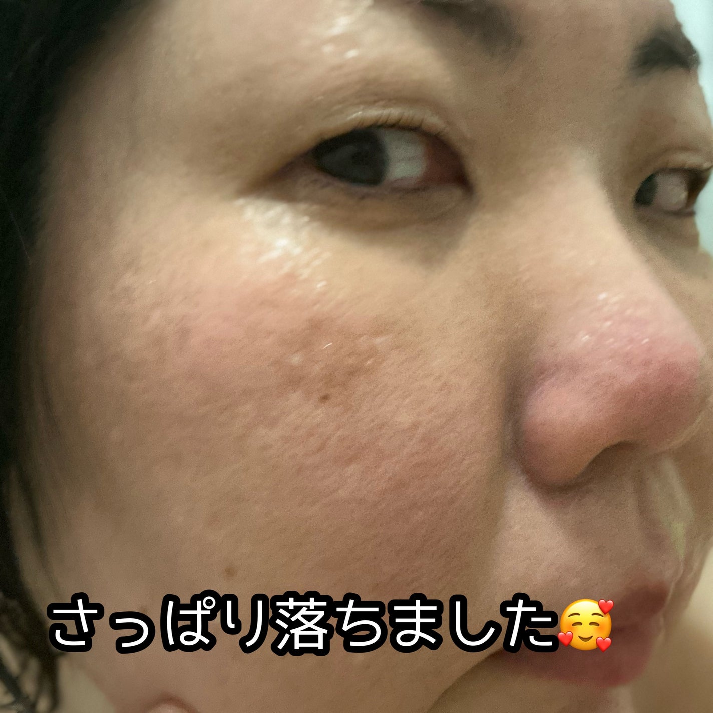 ドクダミ ポアコントロールクレンジングオイル/Anua/オイルクレンジングを使ったクチコミ(3枚目)