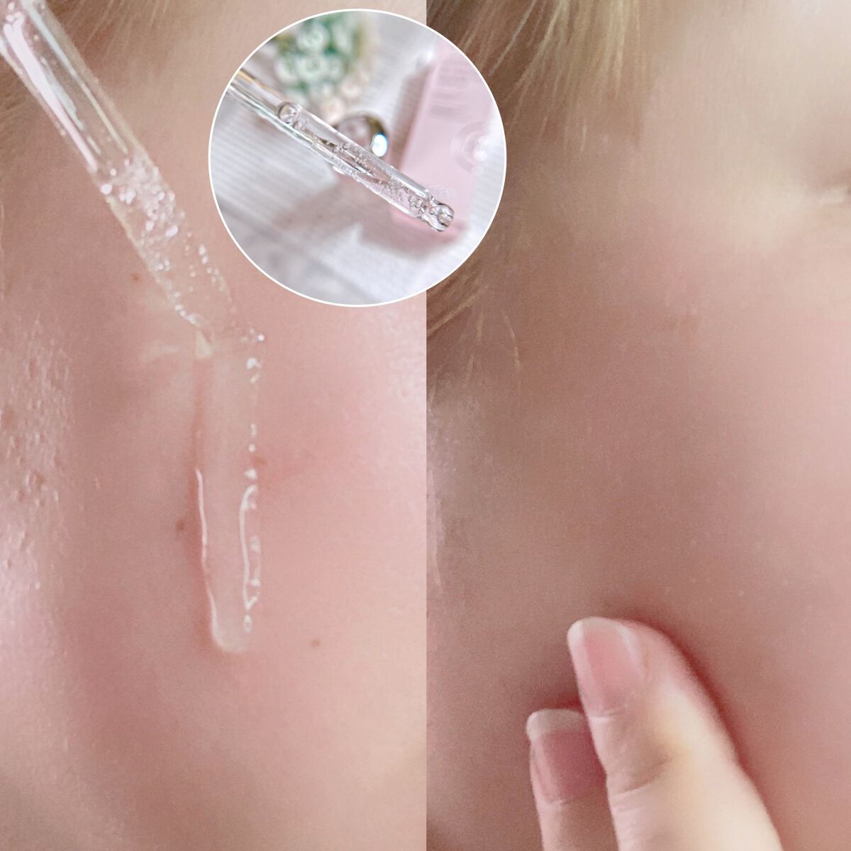 チェリーブロッサムブレミッシュ８GFセラム/Bring Back/化粧水を使ったクチコミ（3枚目）