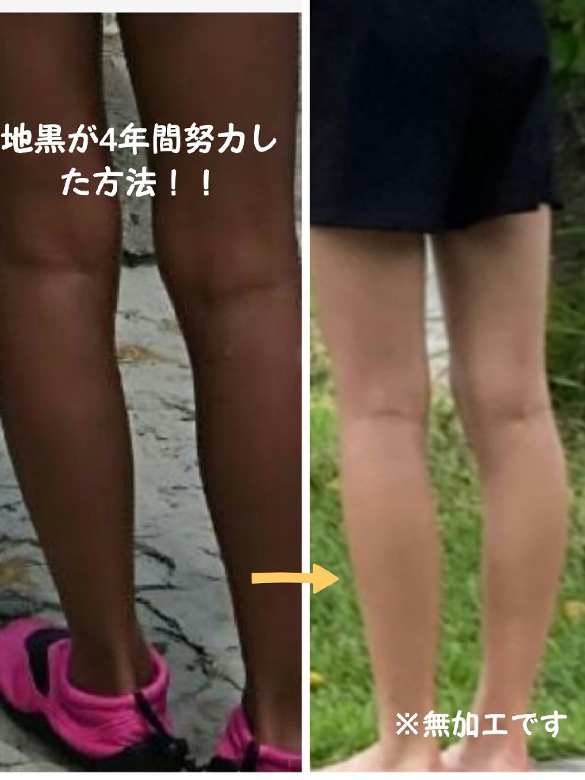 DHC ビタミンＣハードカプセル/DHC/美容サプリメントを使ったクチコミ（1枚目）