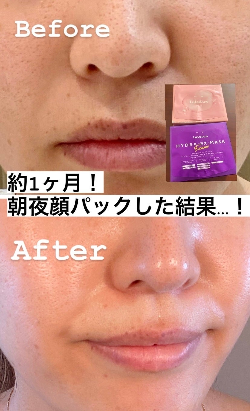 ルルルンピュア エブリーズ/ルルルン/シートマスク・パックを使ったクチコミ(1枚目)