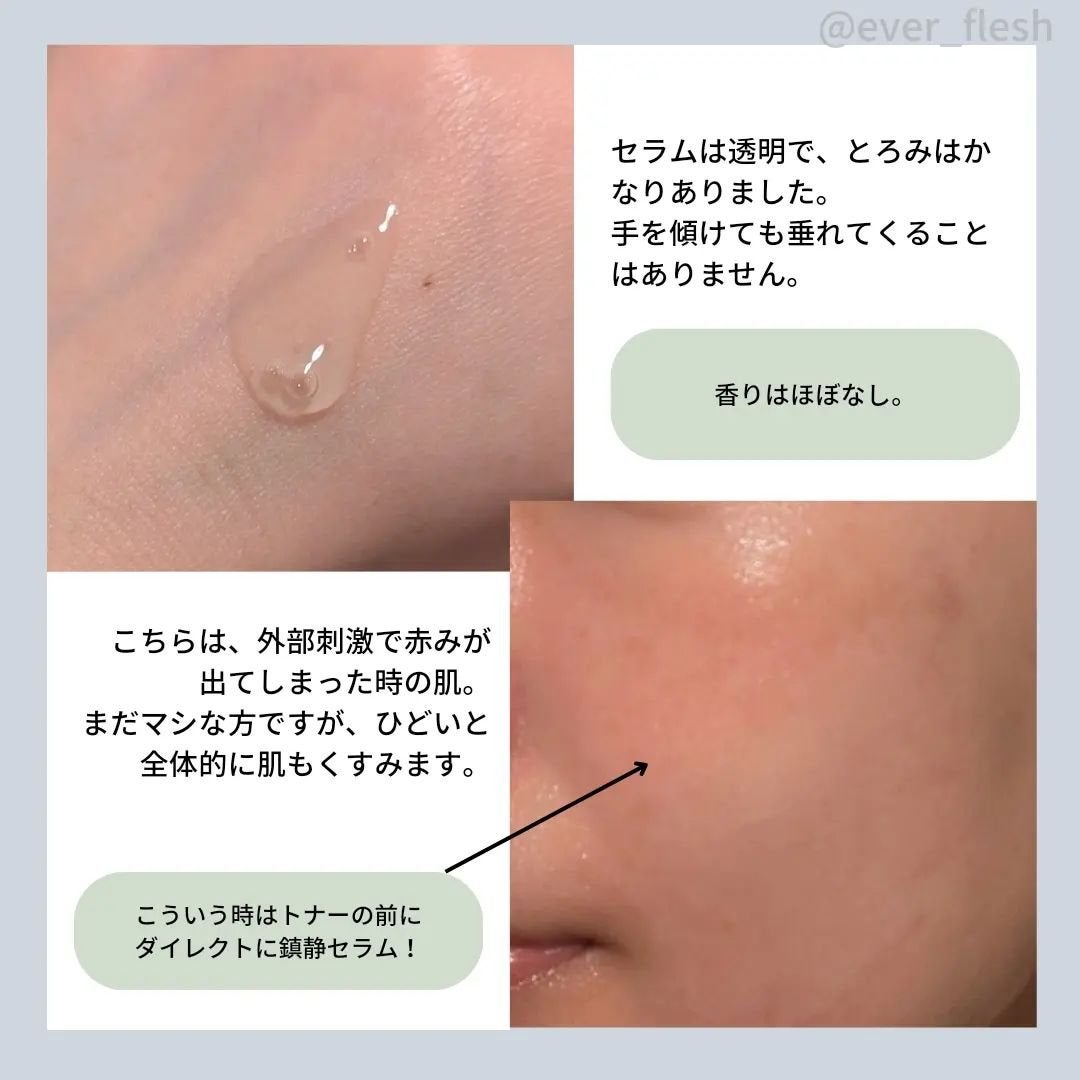 松の木鎮静シカアンプル/ROUND LAB/美容液を使ったクチコミ(6枚目)