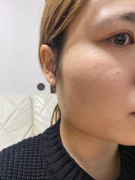 ディオールスキン フォーエヴァー フルイド グロウ/Dior/リキッドファンデーションを使ったクチコミ(2枚目)