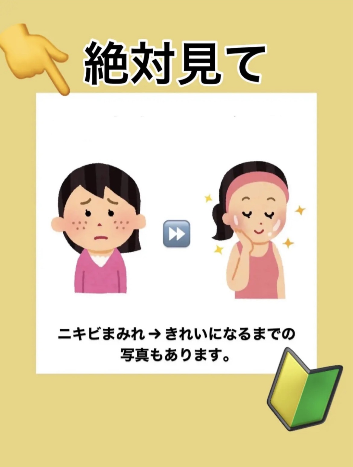 パーフェクトホイップ アクネケア/SENKA（専科）/洗顔フォームを使ったクチコミ（1枚目）