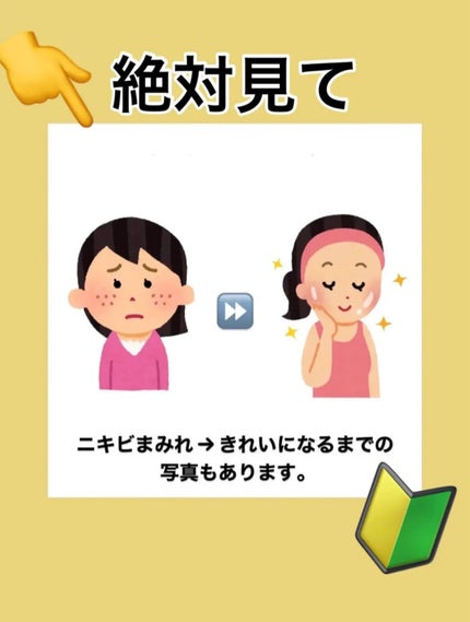 パーフェクトホイップ アクネケア/SENKA(専科)/洗顔フォームを使ったクチコミ(1枚目)