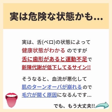 あなたの肌に合ったスキンケア💐コーくん on LIPS 「【あてはまったらヤバい。】舌がこんな形の人は危険です。..あな..」（3枚目）