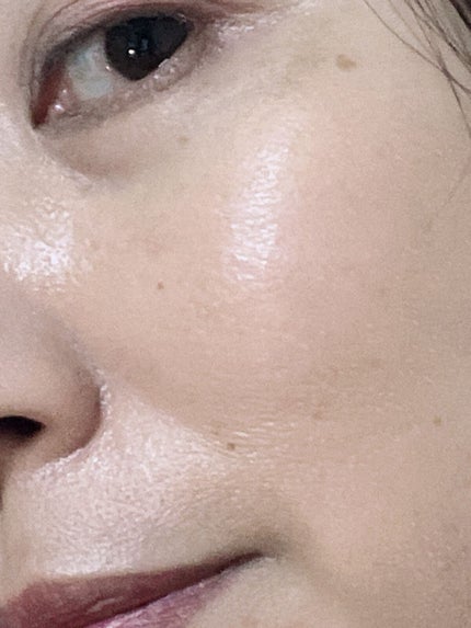 TX-Cream PLUS +/Dr.Melaxin/フェイスクリームを使ったクチコミ(2枚目)