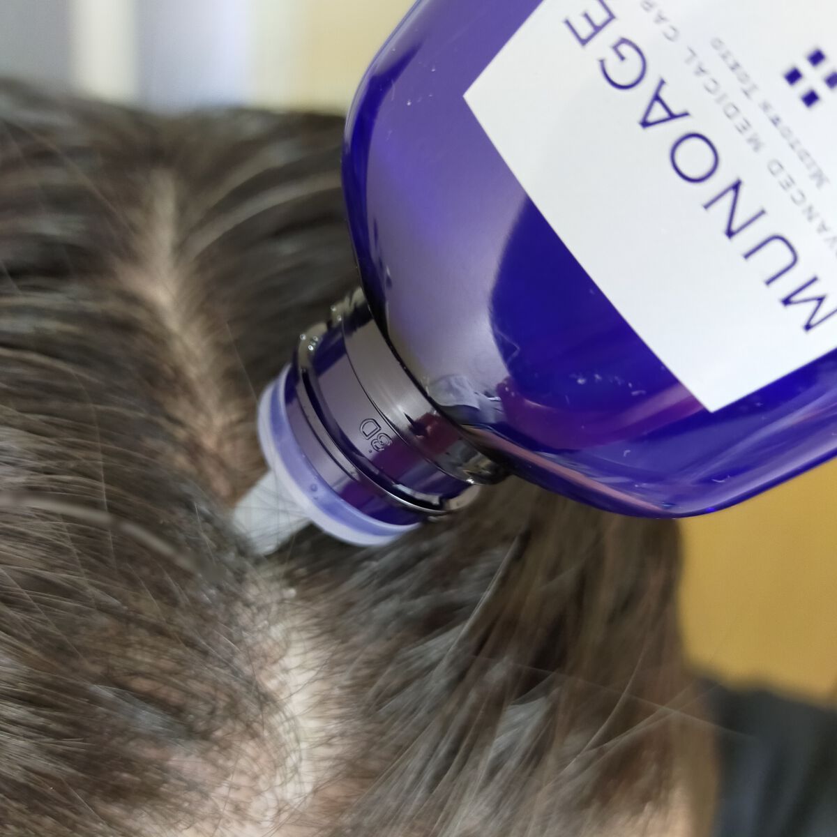 Wアプローチヘアプログラム/MUNOAGE(ミューノアージュ)/頭皮ローションを使ったクチコミ(2枚目)