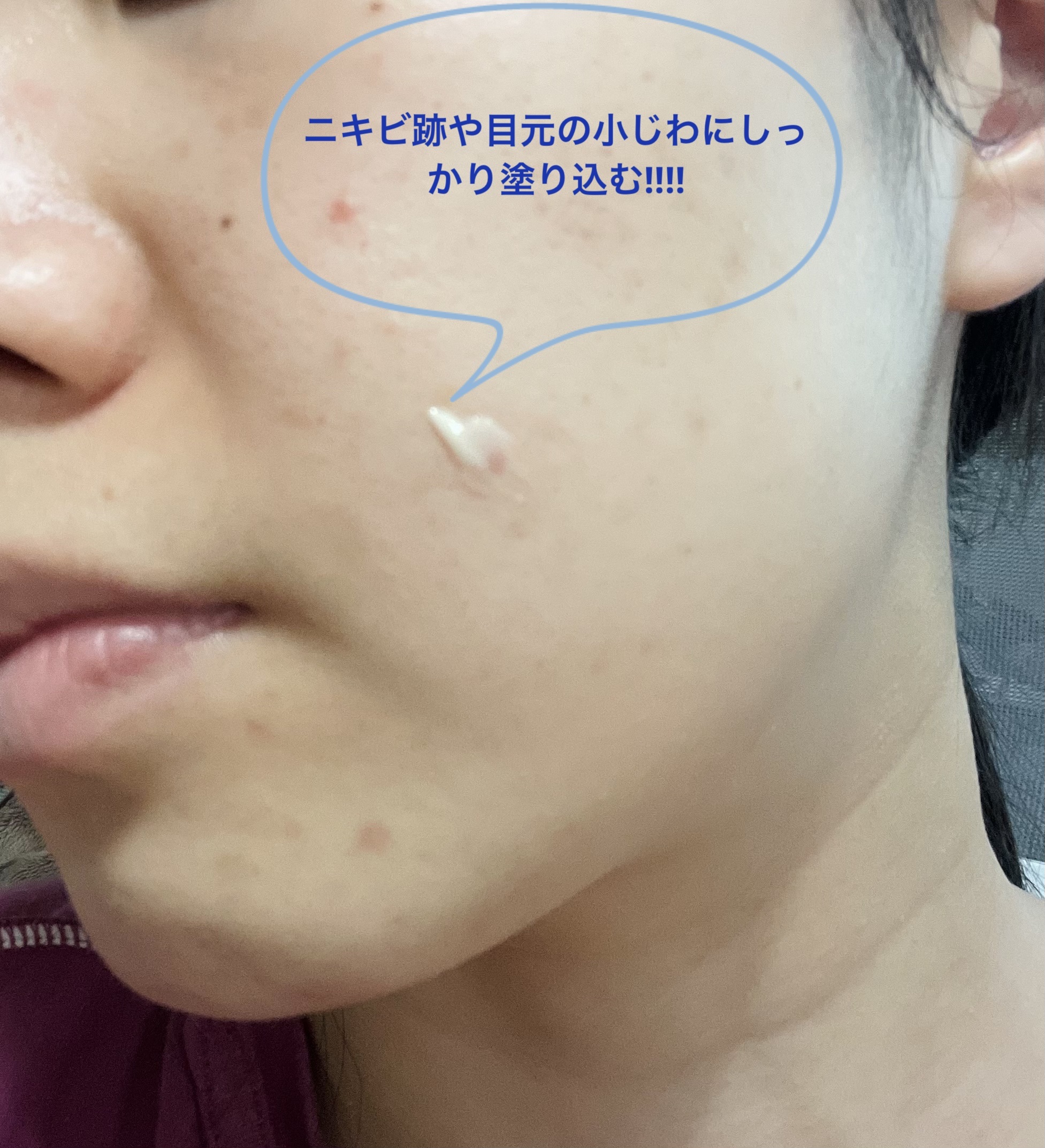 レチノール エキスパート0.1%/IOPE/美容液を使ったクチコミ（3枚目）