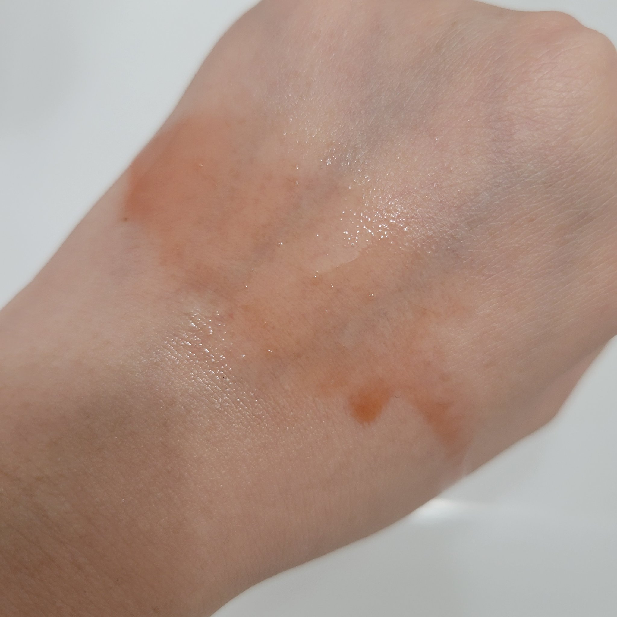 レッドアクネ ボディピーリングショット/MEDICUBE/ピーリングを使ったクチコミ（3枚目）