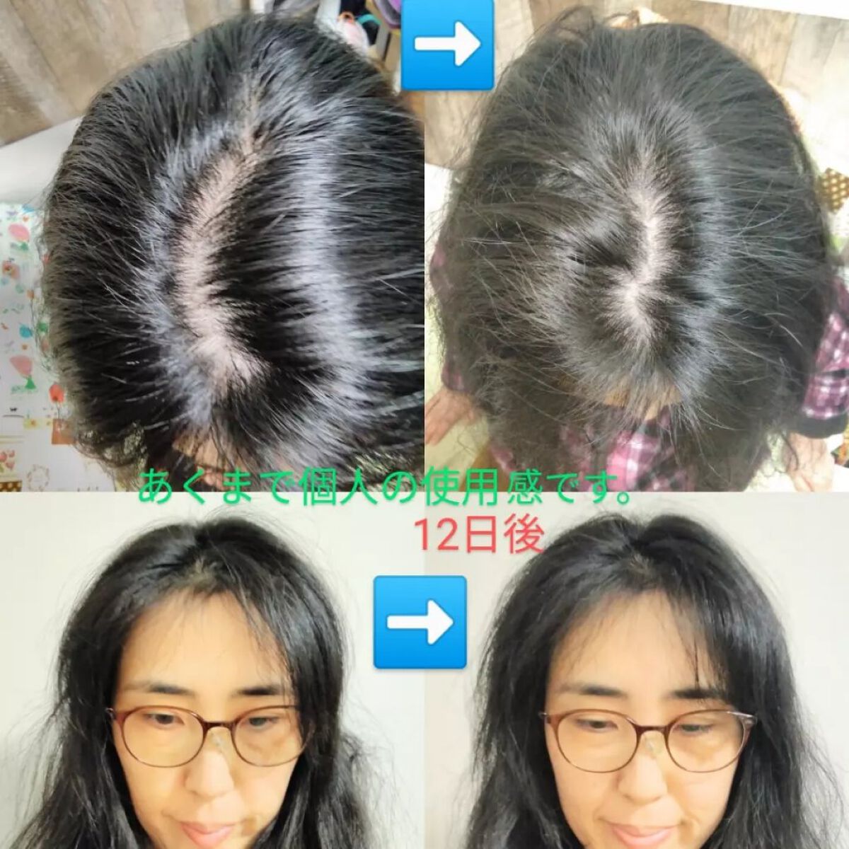 女性用育毛剤 puro fiore/CLOTHASSIS/頭皮ローションを使ったクチコミ(1枚目)