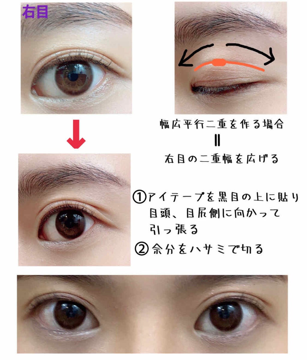 のびーるアイテープ(絆創膏タイプ、レギュラー)/DAISO/二重まぶた用アイテムを使ったクチコミ(3枚目)