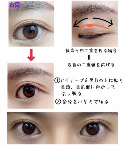 アイテープ(絆創膏タイプ、レギュラー、70枚)/DAISO/二重まぶた用アイテムを使ったクチコミ(3枚目)