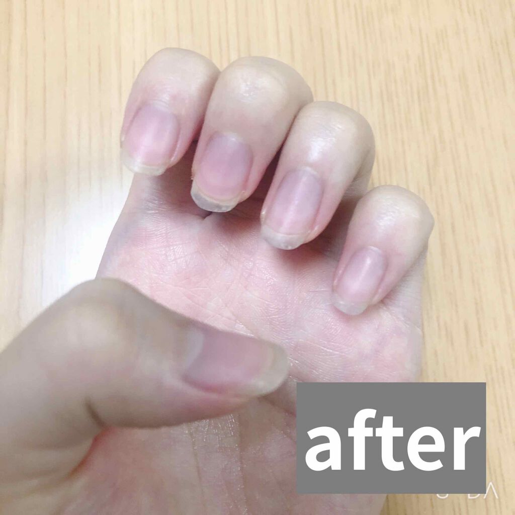 EB ジェルリムーバー/eternal basic/除光液を使ったクチコミ（3枚目）