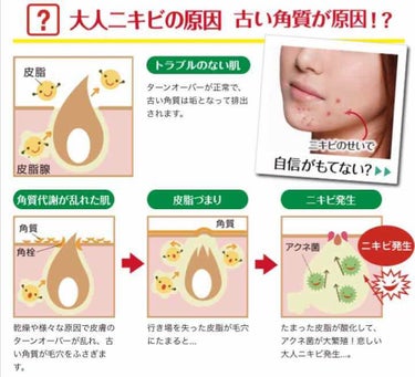 もね on LIPS 「ACNEBARRIERAHASOAPBAR80g1404円(税..」（2枚目）