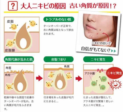 もね on LIPS 「ACNEBARRIERAHASOAPBAR80g1404円(税..」(2枚目)