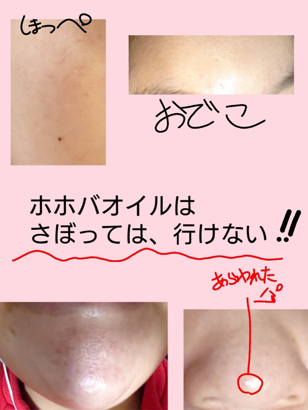 極潤 ヒアルロン液(旧)/肌ラボ/化粧水を使ったクチコミ（2枚目）