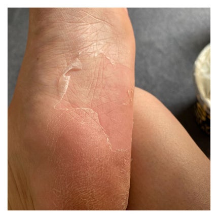 かかと どうスルん??そうスルんDX/Stay Free/レッグ・フットケアを使ったクチコミ(5枚目)