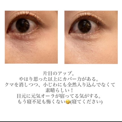 コレクチュールエクラプールレジュー/クレ・ド・ポー ボーテ/リキッドコンシーラーを使ったクチコミ(5枚目)