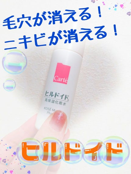 モイスチュア ローション/カルテHD/化粧水を使ったクチコミ(1枚目)