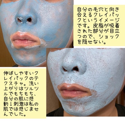 レッドアクネピーリングセラム/MEDICUBE/美容液を使ったクチコミ(2枚目)