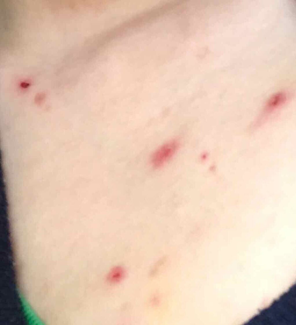 ケアセラ APフェイス＆ボディ乳液/ケアセラ/ボディミルクを使ったクチコミ（2枚目）