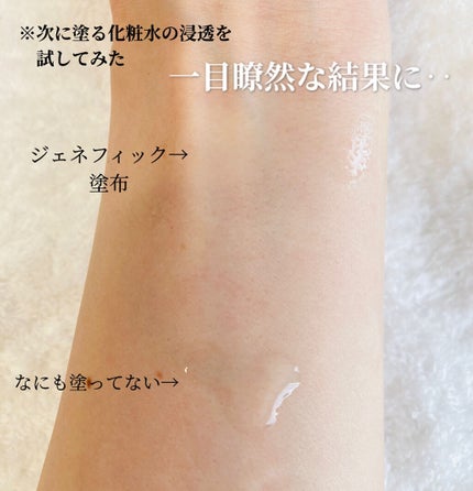 ジェニフィック アドバンスト N/LANCOME/美容液を使ったクチコミ(5枚目)