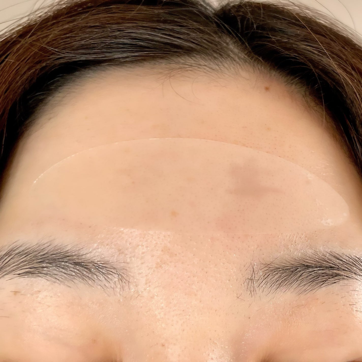 リンクルリペアしわパッチ/MARSHIQUE/その他スキンケアを使ったクチコミ(3枚目)