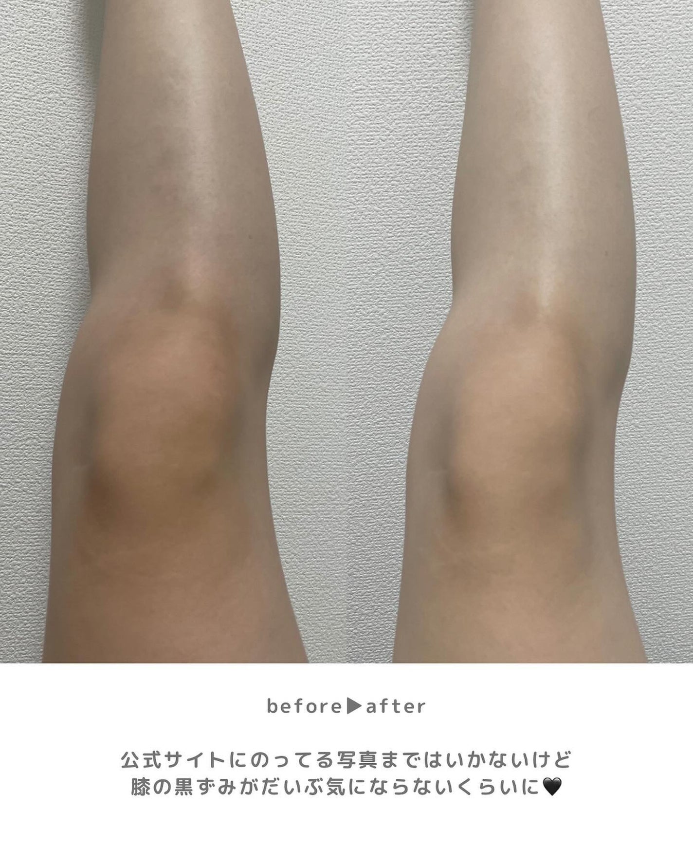 あずさ@スキンケアマニア on LIPS 「🙌全身白くなりたい人集合🙌塗って洗い流すだけ!BOMLight..」(5枚目)