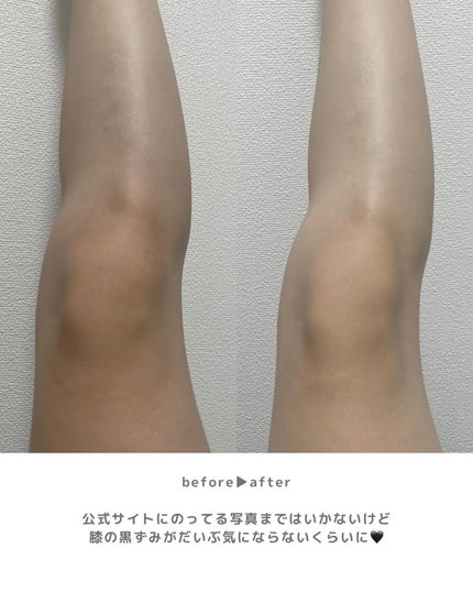 あずさ@スキンケアマニア on LIPS 「🙌全身白くなりたい人集合🙌塗って洗い流すだけ!BOMLight..」(5枚目)