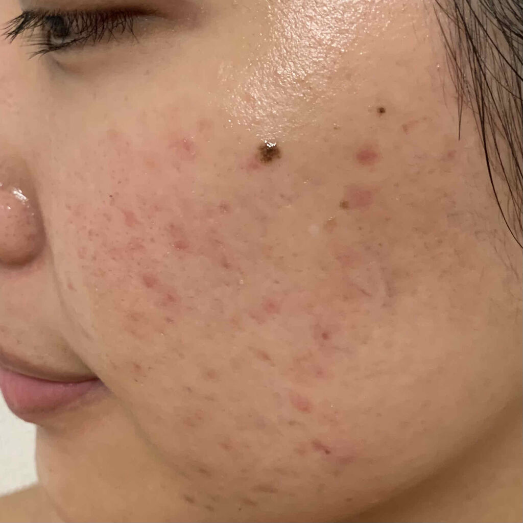 クリアウォッシュ/オルビス/洗顔フォームを使ったクチコミ（1枚目）