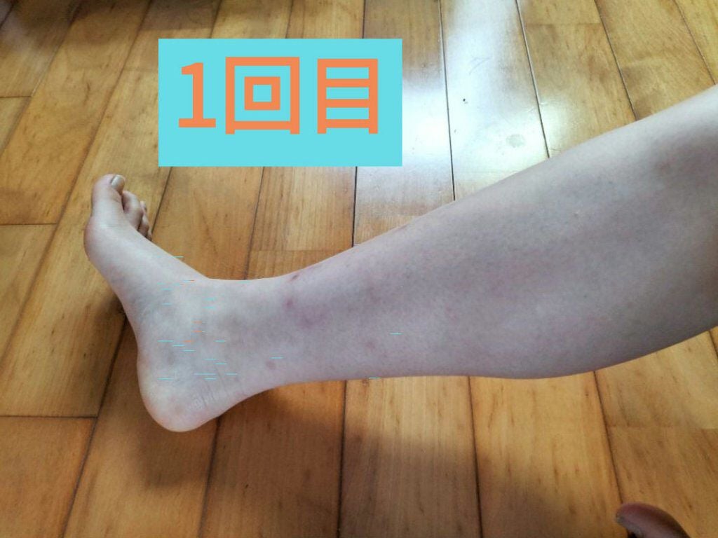 momo ෆ on LIPS 「ひなちゃんねる様の脚やせ動画8回目。一回目の写真と比べてみまし..」(4枚目)