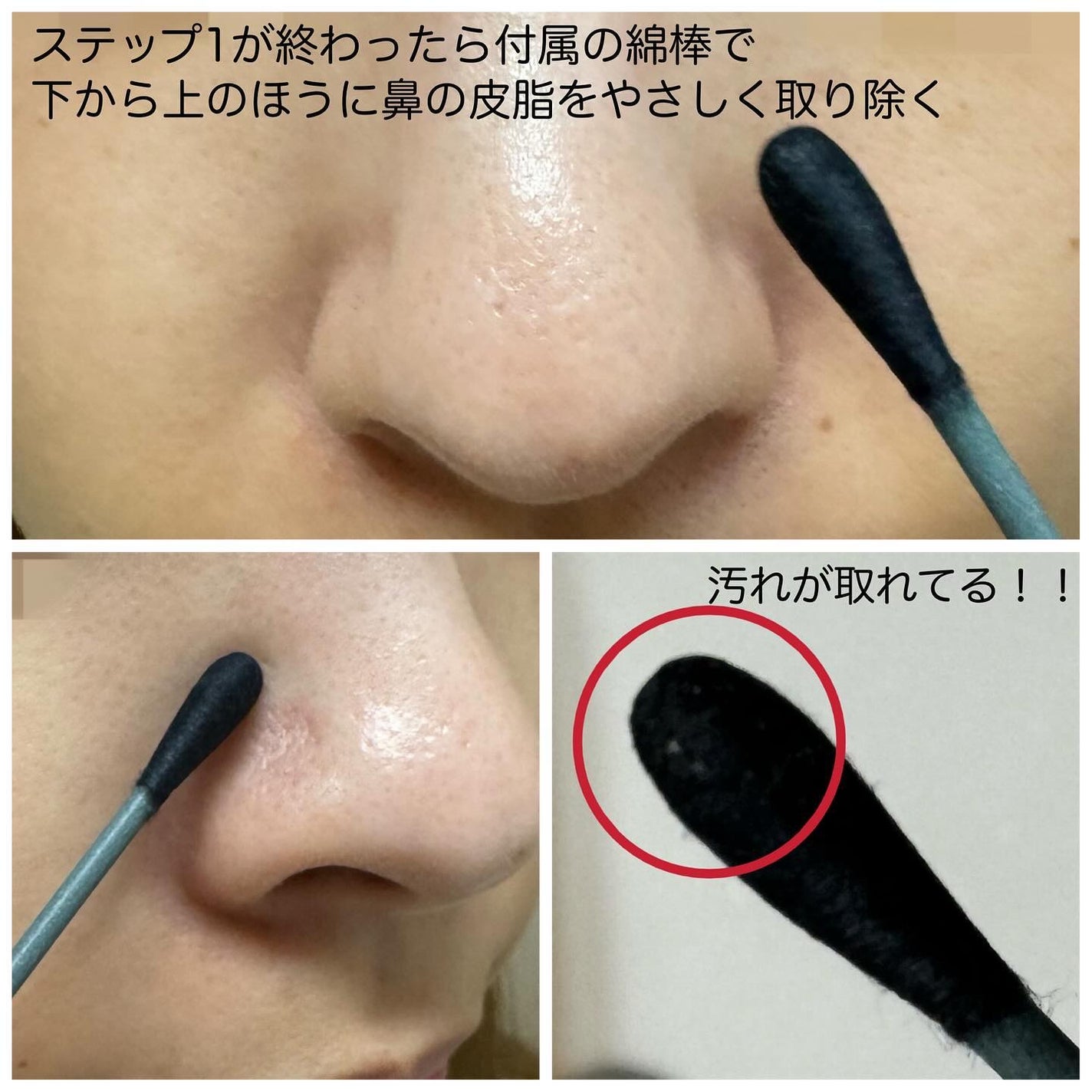 アンチポアブラックヘッドパーフェクトクリアキット/CNP Laboratory/シートマスク・パックを使ったクチコミ(5枚目)