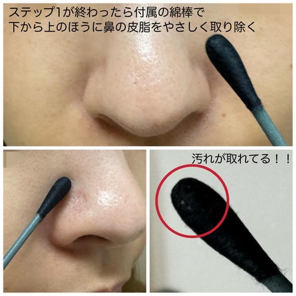 アンチポアブラックヘッドパーフェクトクリアキット/CNP Laboratory/シートマスク・パックを使ったクチコミ(5枚目)