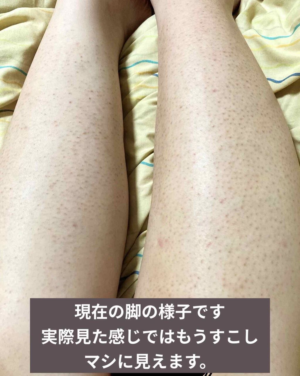 シーズンズ アフターケアトリートメント ハード Seasonsを使った口コミ 自分用記録 被験者 は多い方が良いかと思 By ひな 混合肌 代前半 Lips