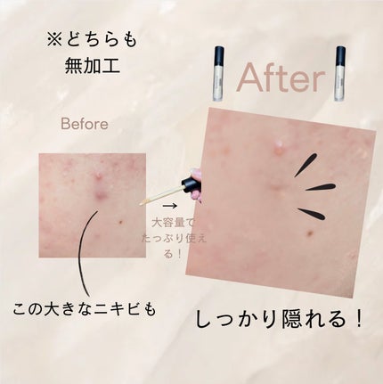 ベアプロ 16HR オールオーバー コンシーラー SPF25(PA+++)/bareMinerals/リキッドコンシーラーを使ったクチコミ(3枚目)