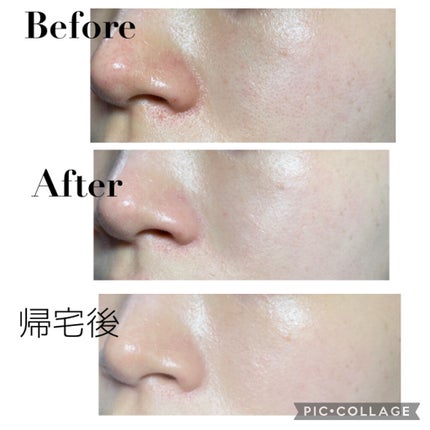 薬用クリアエステヴェール/Macchia Label/リキッドファンデーションを使ったクチコミ(2枚目)