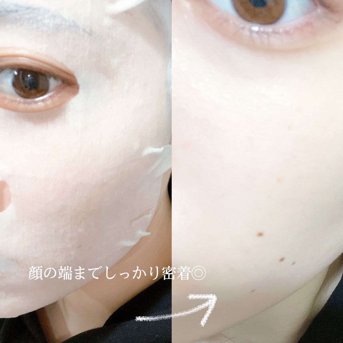 ルルルンピュア エブリーズ/ルルルン/シートマスク・パックを使ったクチコミ(5枚目)