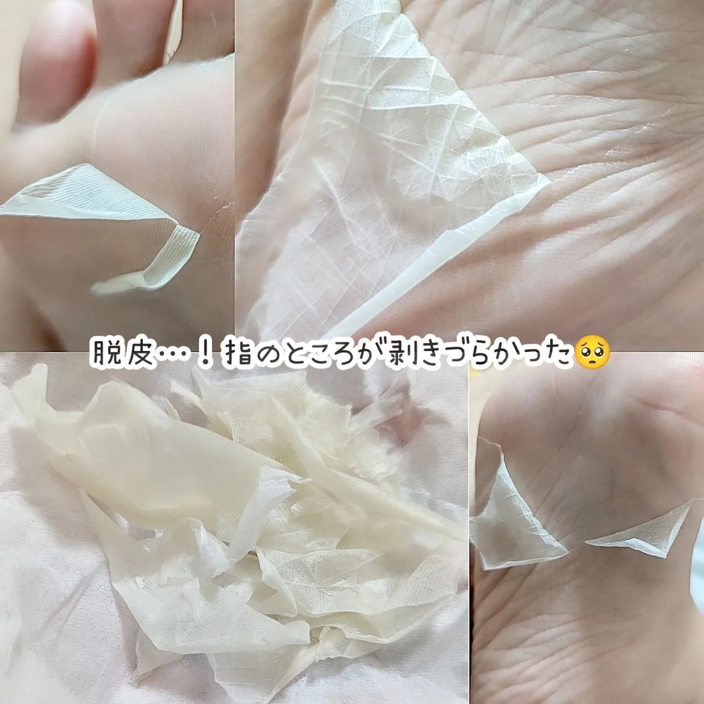 あしやすめ 足裏角質ケアパック/鎌倉ライフ/レッグ・フットケアを使ったクチコミ(4枚目)