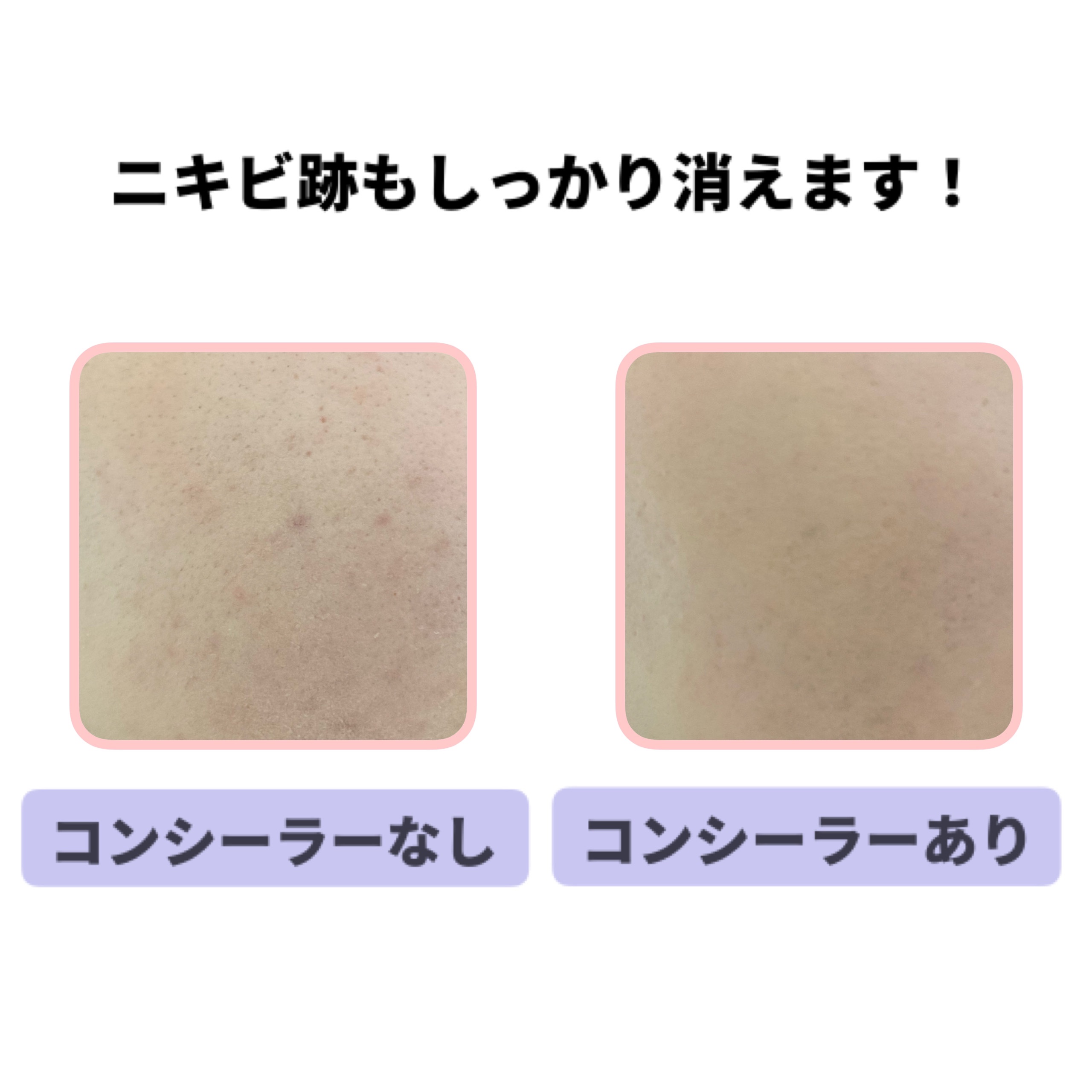 カバーパーフェクション チップコンシーラー/the SAEM/リキッドコンシーラーを使ったクチコミ（3枚目）