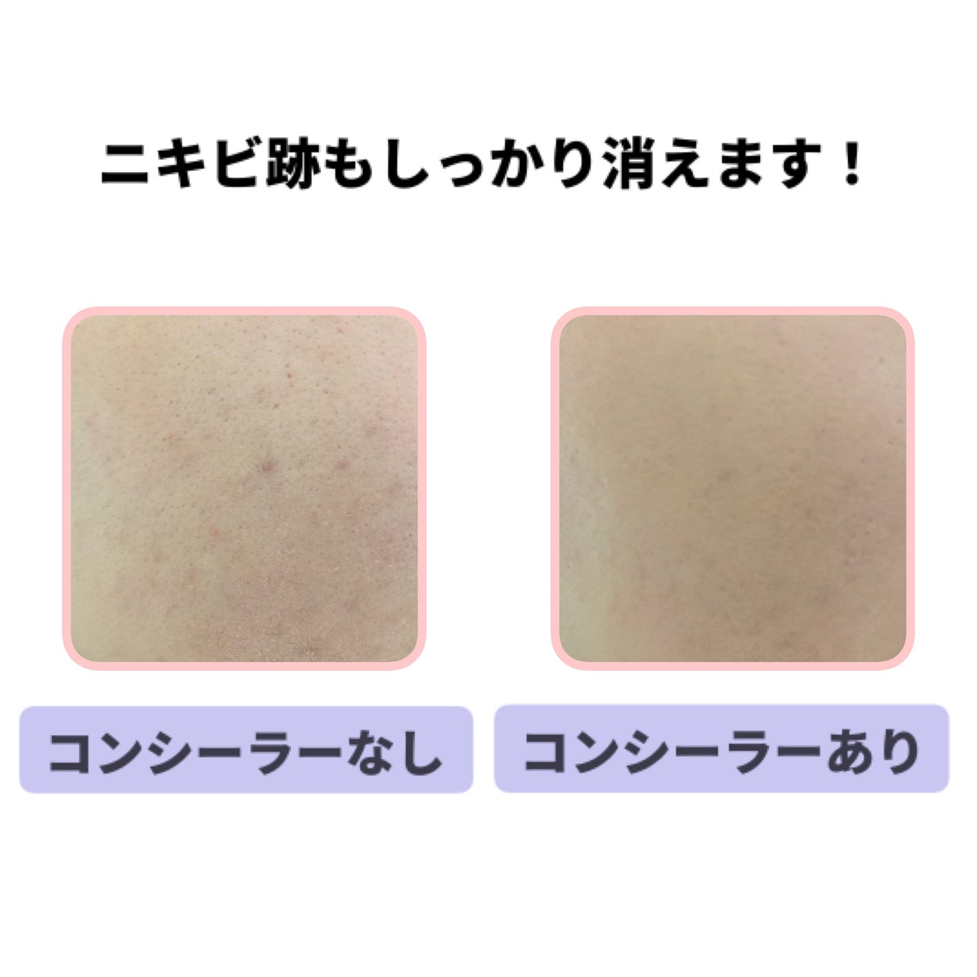 カバーパーフェクション チップコンシーラー/the SAEM/リキッドコンシーラーを使ったクチコミ(3枚目)