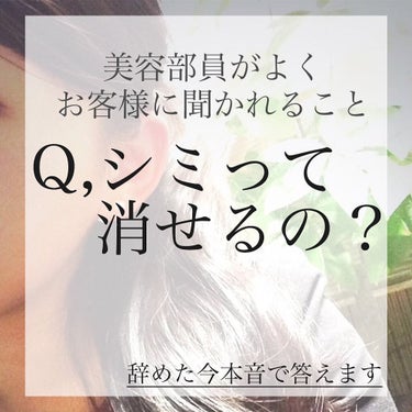 【消すって言葉の定義がちょっと難しい】
美容部員として働いていた時
お客様からよく聞かれた質問に、

美容部員を辞めた今、本音で答えます。

「シミって消せるの？」

美白美容液を買うお客様のうちほとん