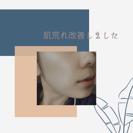 アピットジェル/全薬工業/美容液を使ったクチコミ(3枚目)