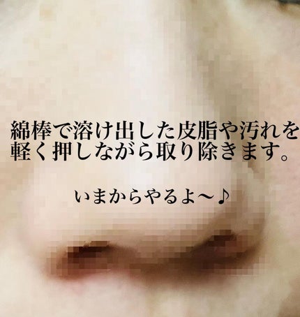 アクレオンセボエクストラクター/ANACIS/その他スキンケアを使ったクチコミ(3枚目)