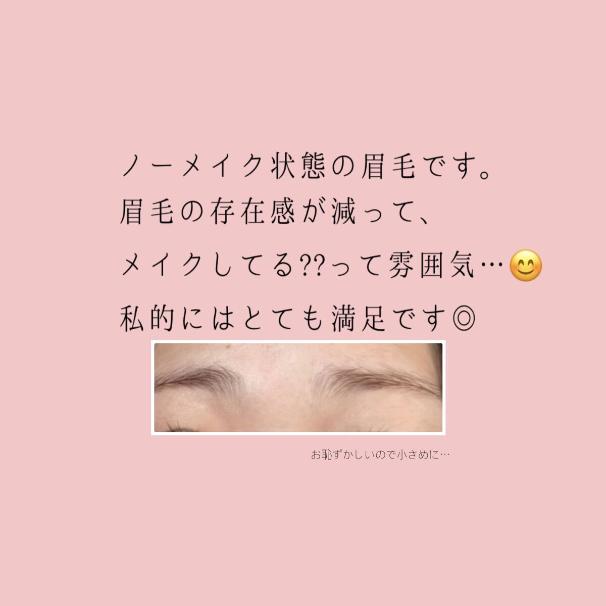 脱色クリーム スピーディー/エピラット/ムダ毛ケアを使ったクチコミ（1枚目）