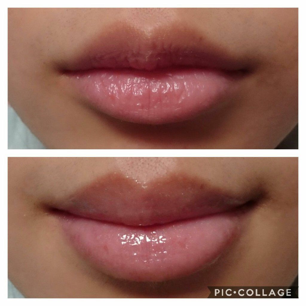 38°C / 99°F リップトリートメント (リップ美容液)/UZU BY FLOWFUSHI/リップケアを使ったクチコミ(5枚目)