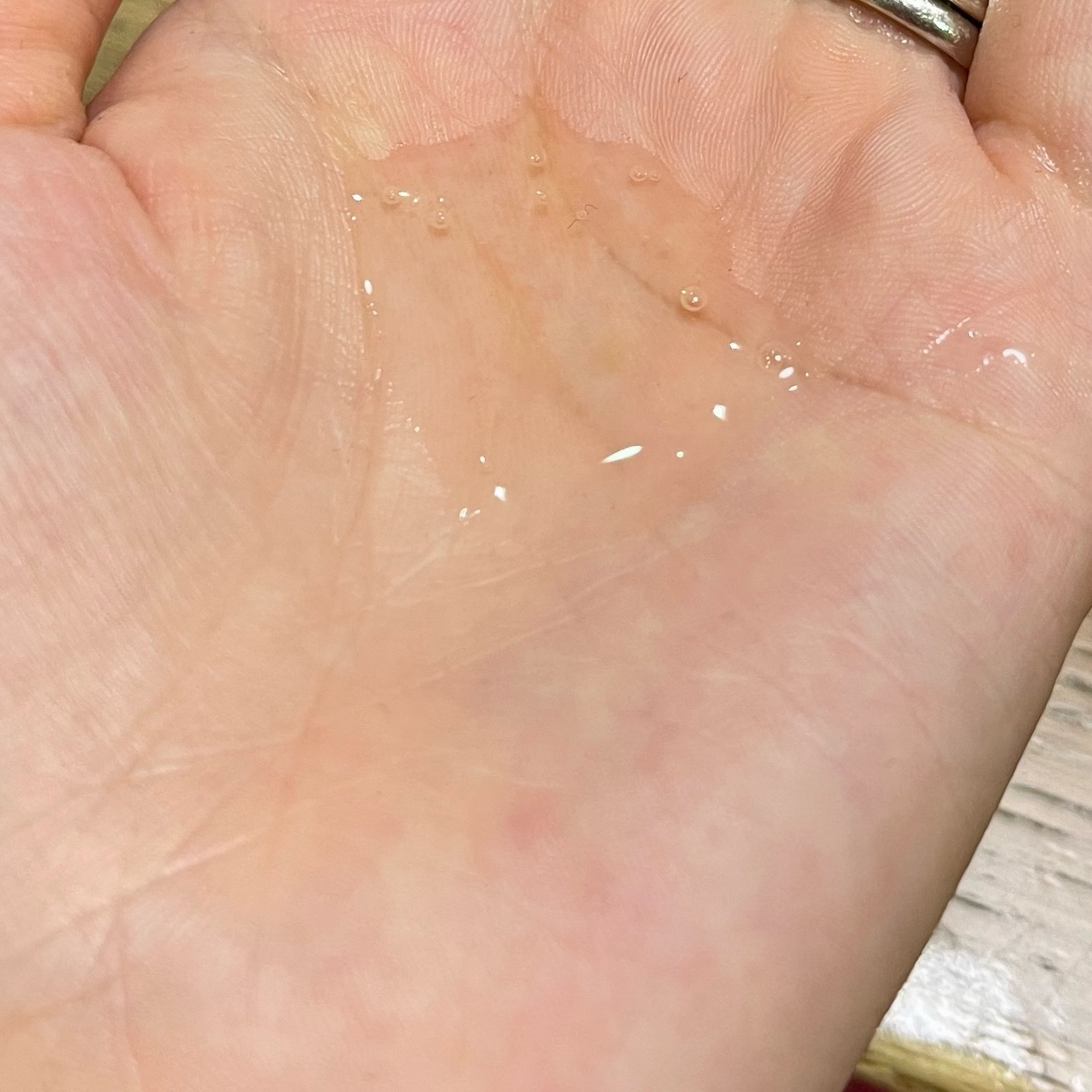 MT エッセンシャル・セラム/MTメタトロン/美容液を使ったクチコミ（2枚目）