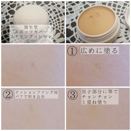 スポッツカバー ファウンデイション/SHISEIDO/クリームコンシーラーを使ったクチコミ(1枚目)
